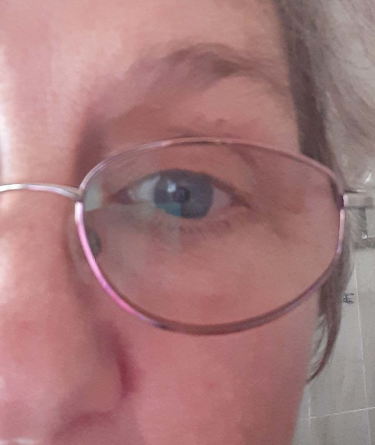My right eye